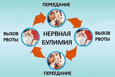 Лечение булимии в Усть-Илимске